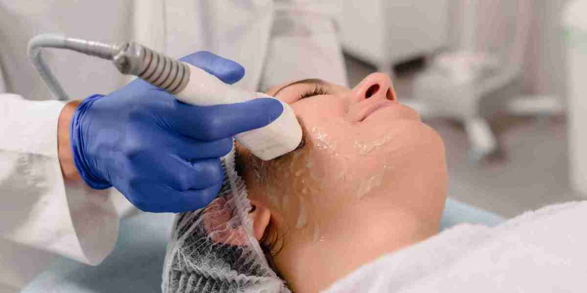 Get Ready for Laser Hair Removal with These Pre-Care Guidelines