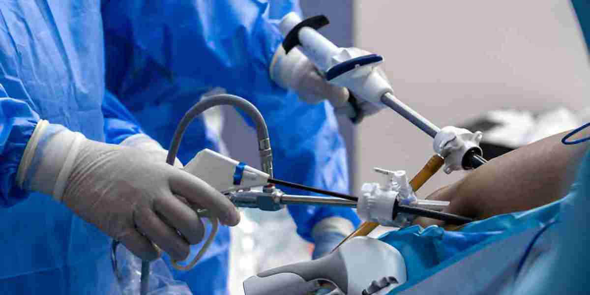 Understanding Gastric Sleeve Surgery in Singapore: A Complete Guide