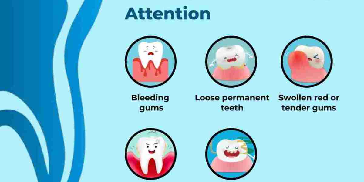 Is It Time for a Dental Refresh? Discover Teeth Cleaning in Bangalore Services