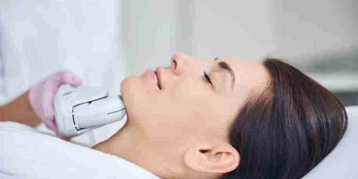How Long Does RF Skin Tightening Last? Dubai Insights