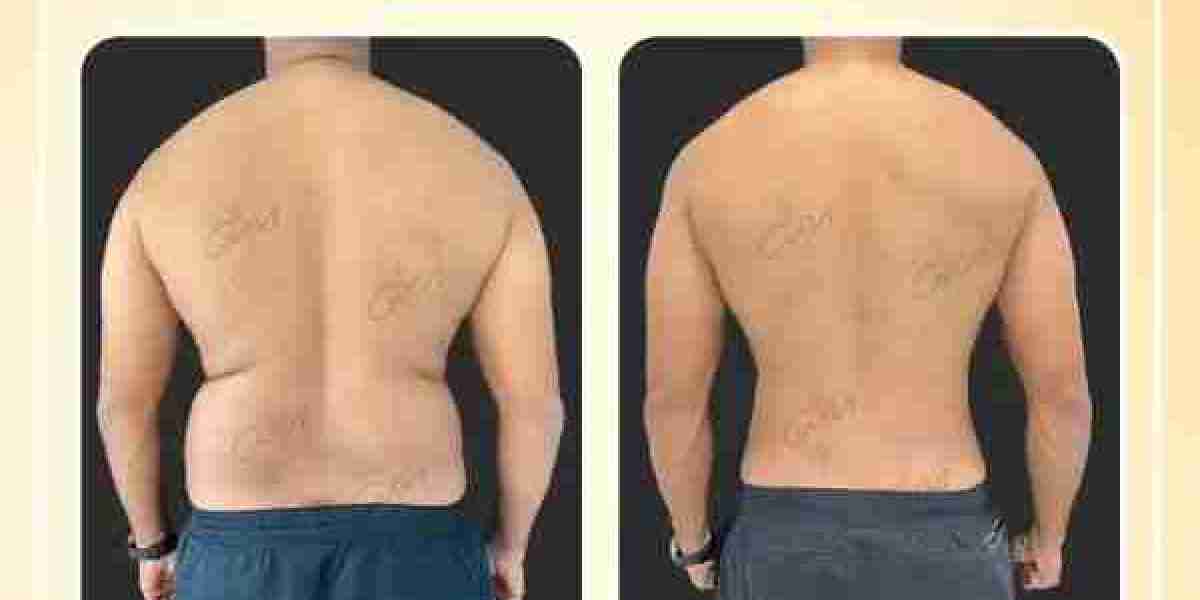 Article Picture
