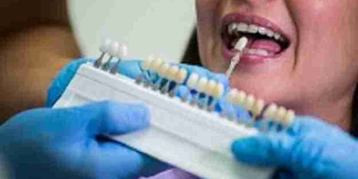 Affordable Dental Care in Melbourne: Your Guide to Bulk Billing Dentists and Clinics